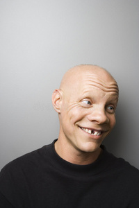 背景上隔离的插图缺件缺牙用拼图拼成的脑袋缺了一块缺件傻老头缺牙在