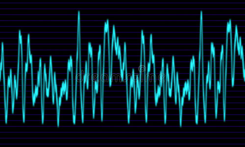 音频或声波图