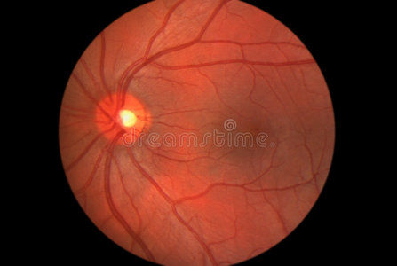 古老的 圆盘 网络 近的 动脉 眼底 显微照相 黄斑 圆圈