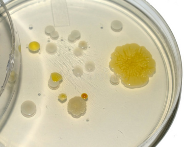 绿色菌落菌落沙门氏菌黑色细菌菌落在沙门氏菌志贺菌琼脂ss琼脂,选择