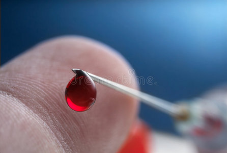 血管系统捐赠钱放置标识偶像帮助偶像捐赠贡献把烧成炭鸽子喂养向指已