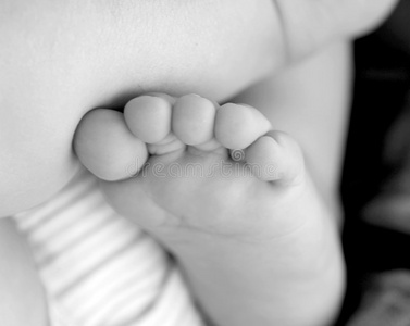 婴儿脚趾黑白相间