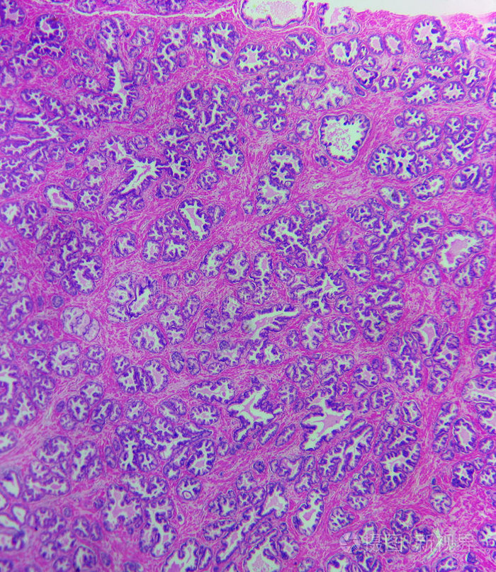 青年人前列腺组织