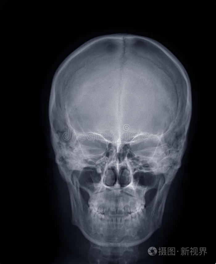 头前封头头血管x光片头骨x光片面x射线查看作者其他作品查看更多>漂亮