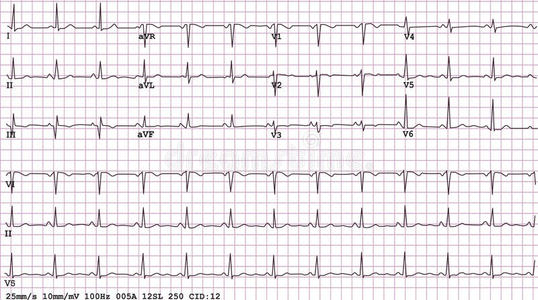 心电图复制图片