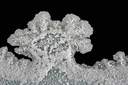 尿酸盐结晶照片图片