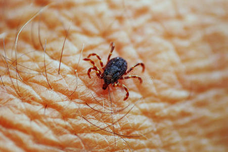 皮肤上的虱子照片