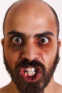 黑眼圈的男人图片