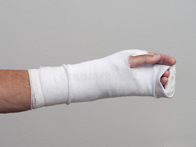 石膏绷带图片
