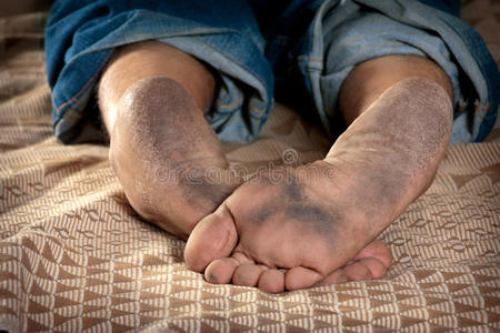 脏脚照片