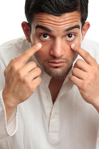 眼睛的男人睡眼惺忪的疲惫的男人血色的眼睛照片