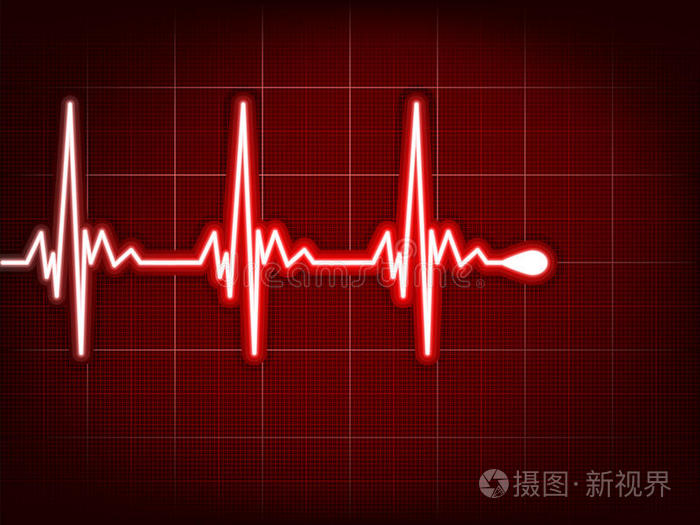 下载小样发票合同问题/举报心跳监护仪心脏心电图上有心脏听诊器和心