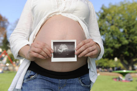 怀孕夫妇抱着婴儿的超声波图像