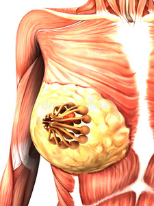 乳腺癌x射线照片