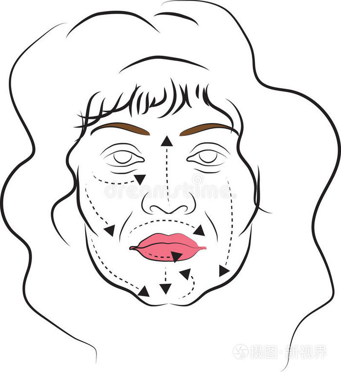 面部整形手术插画-正版商用图片0l83se-摄图新视界