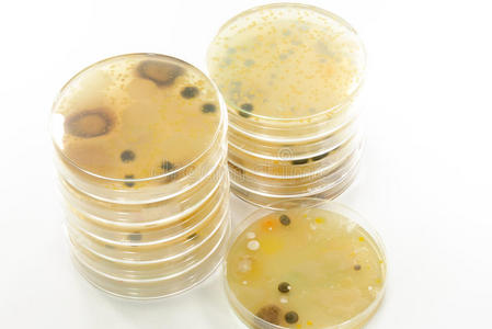 大型霉菌和菌落在aga上的生长照片