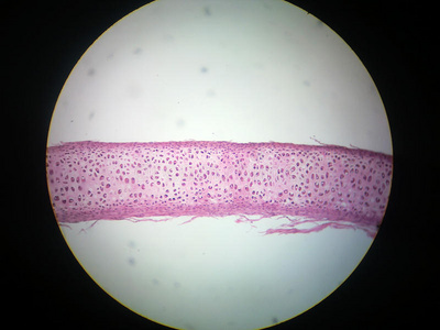 perichondrium软骨细胞照片