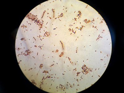 细菌鞭毛大肠杆菌