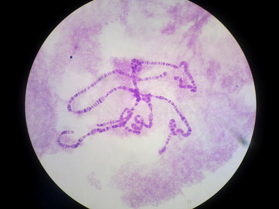 多线染色体巨染色体照片