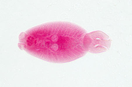 鱼寄生虫丝状贝氏体蠕虫显微照片
