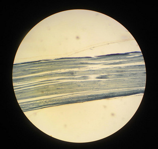 横纹横纹肌照片