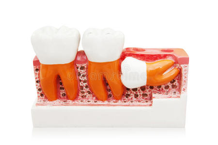 医学 牙龈 牙医 工具 健康 臼齿 特写镜头 诊所 医疗保健