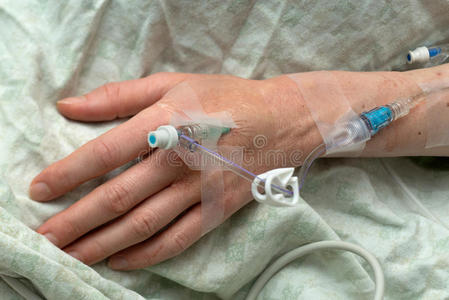 静脉注射针管的妇女手照片