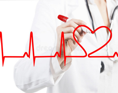 医生画了一个心跳心电图