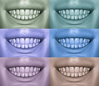 各种牙齿条件图片