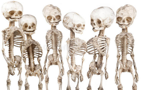 儿童骨骼图片
