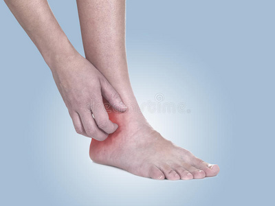女人用手搔痒痒的脚踝。