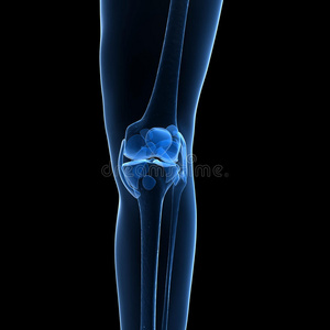 骨性膝关节