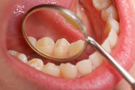 牙科综合检查