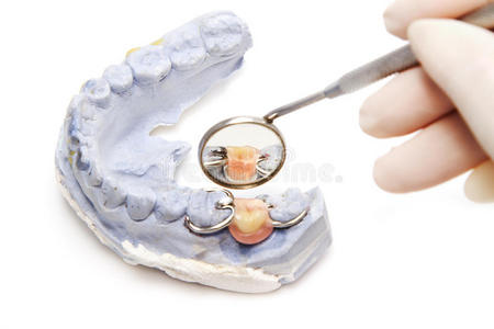 牙科工具义齿