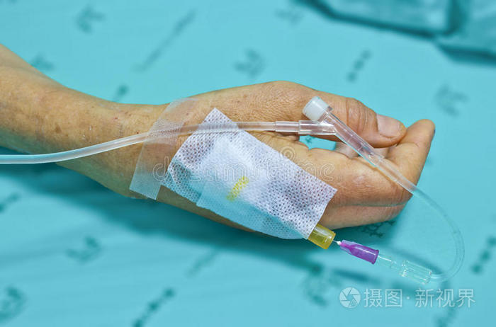 病人手上的静脉输液