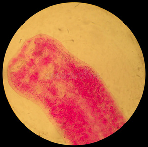 研究 显微照片 组织 健康 器官 指示器 寄生虫 颜色 生物学