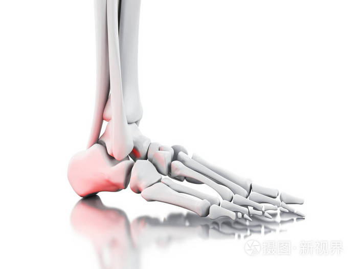 3d踝关节疼痛