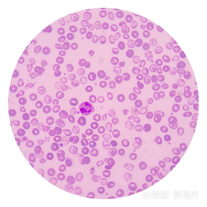 红血细胞白色背景医疗科学