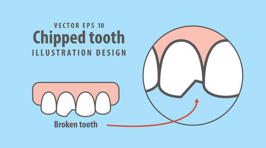 在蓝色背景上有缺口的牙齿插图向量。牙科诈骗