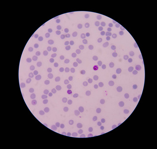 血液红细胞图片