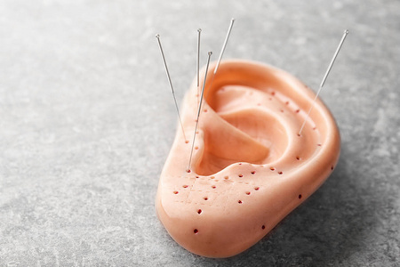 针灸和样机的人耳针照片