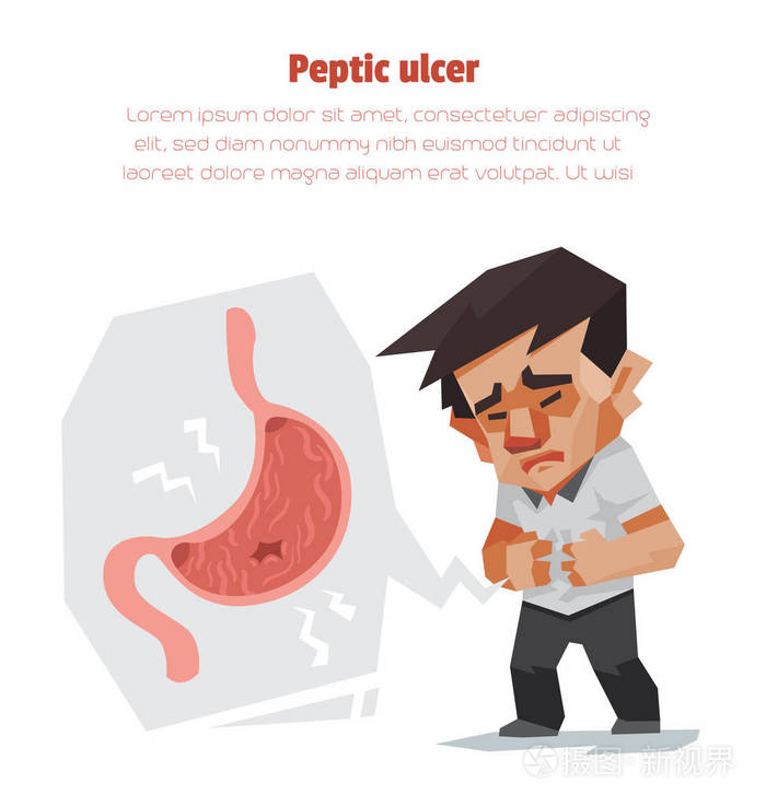 消化性溃疡, 医疗保健信息图形, 矢量插图