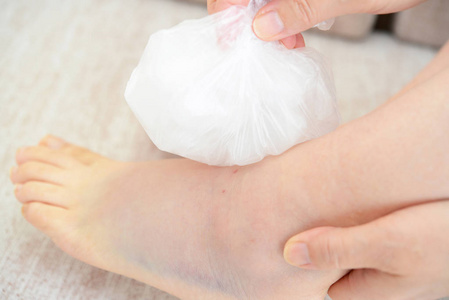 扭伤的脚妇女结冰扭伤脚踝与冰包照片