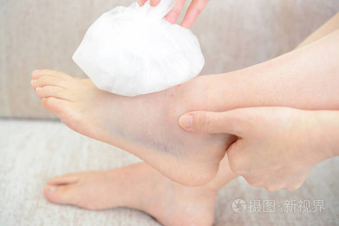 妇女结冰扭伤脚踝与冰包
