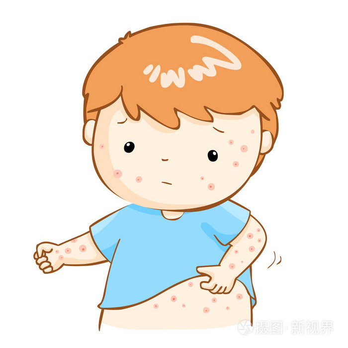 男孩在他的身体矢量挠发痒的皮疹
