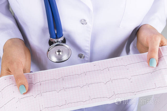 心电图的一名女医生的手中.医疗健康服务.