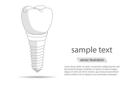 牙科植入标志, 图标。植入牙科和护理牙齿。插图