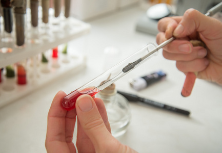 细菌的接种照片