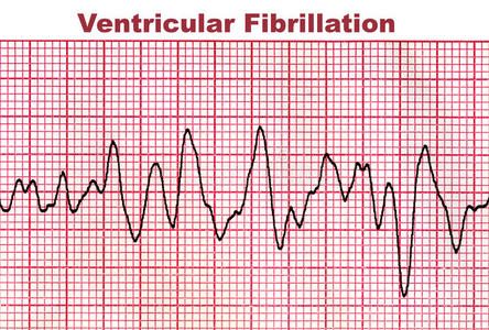 心室图片 心室素材 心室插画 摄图新视界