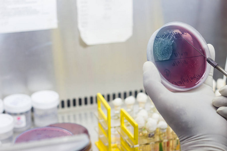 微生物实验室油烟机内的科学家接种循环培养板上的血琼脂接种